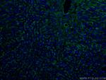 Icam-1 Antibody in Immunohistochemistry (PFA fixed) (IHC (PFA))