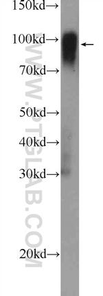 Icam-1 Antibody in Western Blot (WB)