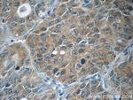 JNK Antibody in Immunohistochemistry (Paraffin) (IHC (P))