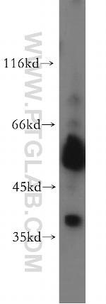 AP1/JUN/P39 Antibody in Western Blot (WB)