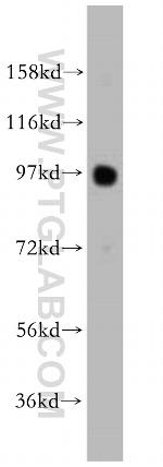 AP1/JUN/P39 Antibody in Western Blot (WB)