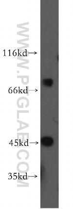 AP1/JUN/P39 Antibody in Western Blot (WB)