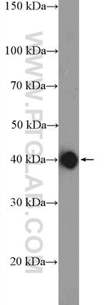 AP1/JUN/P39 Antibody in Western Blot (WB)