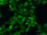 AP1/JUN/P39 Antibody in Immunocytochemistry (ICC/IF)