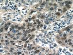AP1/JUN/P39 Antibody in Immunohistochemistry (Paraffin) (IHC (P))