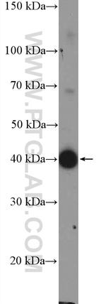AP1/JUN/P39 Antibody in Western Blot (WB)