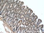 PDK1 Antibody in Immunohistochemistry (Paraffin) (IHC (P))