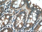 PDK1 Antibody in Immunohistochemistry (Paraffin) (IHC (P))