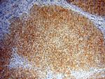 PDK1 Antibody in Immunohistochemistry (Paraffin) (IHC (P))