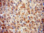 PDK1 Antibody in Immunohistochemistry (Paraffin) (IHC (P))