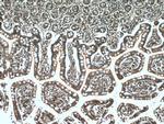 PDK1 Antibody in Immunohistochemistry (Paraffin) (IHC (P))
