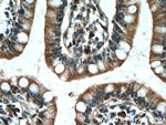 PDK1 Antibody in Immunohistochemistry (Paraffin) (IHC (P))