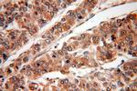 Paxillin Antibody in Immunohistochemistry (Paraffin) (IHC (P))