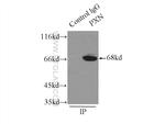 Paxillin Antibody in Immunoprecipitation (IP)