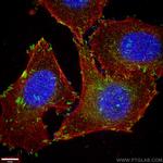 Paxillin Antibody in Immunocytochemistry (ICC/IF)