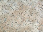Dynamitin (69-376 AA) Antibody in Immunohistochemistry (Paraffin) (IHC (P))
