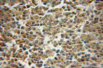 Dynamitin (69-376 AA) Antibody in Immunohistochemistry (Paraffin) (IHC (P))