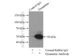Dynamitin (69-376 AA) Antibody in Immunoprecipitation (IP)