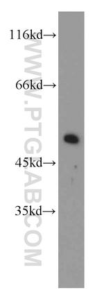 Dynamitin (69-376 AA) Antibody in Western Blot (WB)