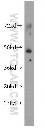 Dynamitin (69-376 AA) Antibody in Western Blot (WB)