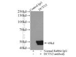 Dynamitin (1-83 AA) Antibody in Immunoprecipitation (IP)