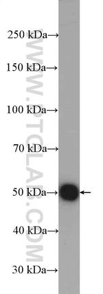 Dynamitin (1-83 AA) Antibody in Western Blot (WB)