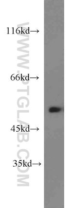 Dynamitin (1-83 AA) Antibody in Western Blot (WB)