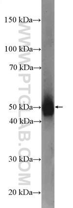 Dynamitin (1-83 AA) Antibody in Western Blot (WB)