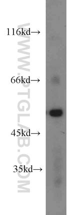 Dynamitin (1-86 AA) Antibody in Western Blot (WB)