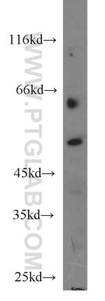 Dynamitin (1-86 AA) Antibody in Western Blot (WB)
