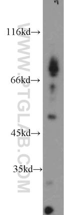Dynamitin (1-86 AA) Antibody in Western Blot (WB)