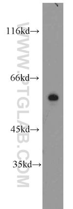 MAPK7 Antibody in Western Blot (WB)