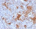 Cadherin-6 (CDH6)/K-Cadherin Monoclonal Antibody (CDH6/3191)
