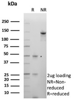 Cadherin-6 (CDH6)/K-Cadherin Antibody in SDS-PAGE (SDS-PAGE)