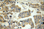 RB1CC1 Antibody in Immunohistochemistry (Paraffin) (IHC (P))