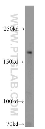 RB1CC1 Antibody in Western Blot (WB)