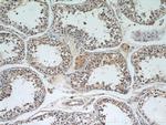 RB1CC1 Antibody in Immunohistochemistry (Paraffin) (IHC (P))