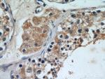 RB1CC1 Antibody in Immunohistochemistry (Paraffin) (IHC (P))