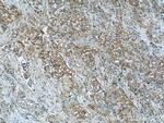 RB1CC1 Antibody in Immunohistochemistry (Paraffin) (IHC (P))