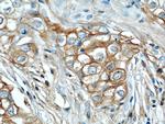 RB1CC1 Antibody in Immunohistochemistry (Paraffin) (IHC (P))