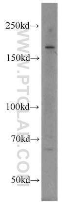 RB1CC1 Antibody in Western Blot (WB)