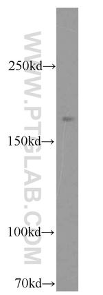 RB1CC1 Antibody in Western Blot (WB)