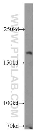 RB1CC1 Antibody in Western Blot (WB)