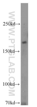 RB1CC1 Antibody in Western Blot (WB)