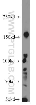 RB1CC1 Antibody in Western Blot (WB)