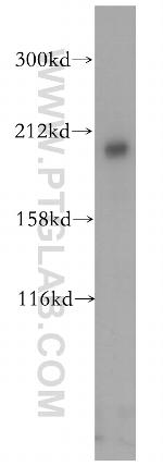RB1CC1 Antibody in Western Blot (WB)