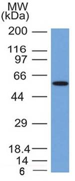 Occludin (Marker of Early Blood Brain Barrier Damage) Antibody in Western Blot (WB)