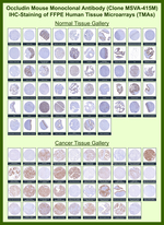 Occludin (Marker of Early Blood Brain Barrier Damage) Monoclonal Antibody (MSVA-415M)