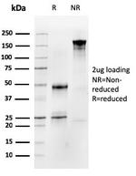 Occludin (OCLN) (Tight Junctions Marker) Antibody in SDS-PAGE (SDS-PAGE)