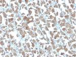 MICA Antibody in Immunohistochemistry (Paraffin) (IHC (P))